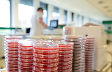 Petrischaaltjes in het laboratorium Medische Microbiologie